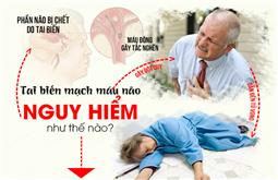 Bác sĩ chỉ rõ 5 di chứng tai biến mạch máu não thường gặp nhất